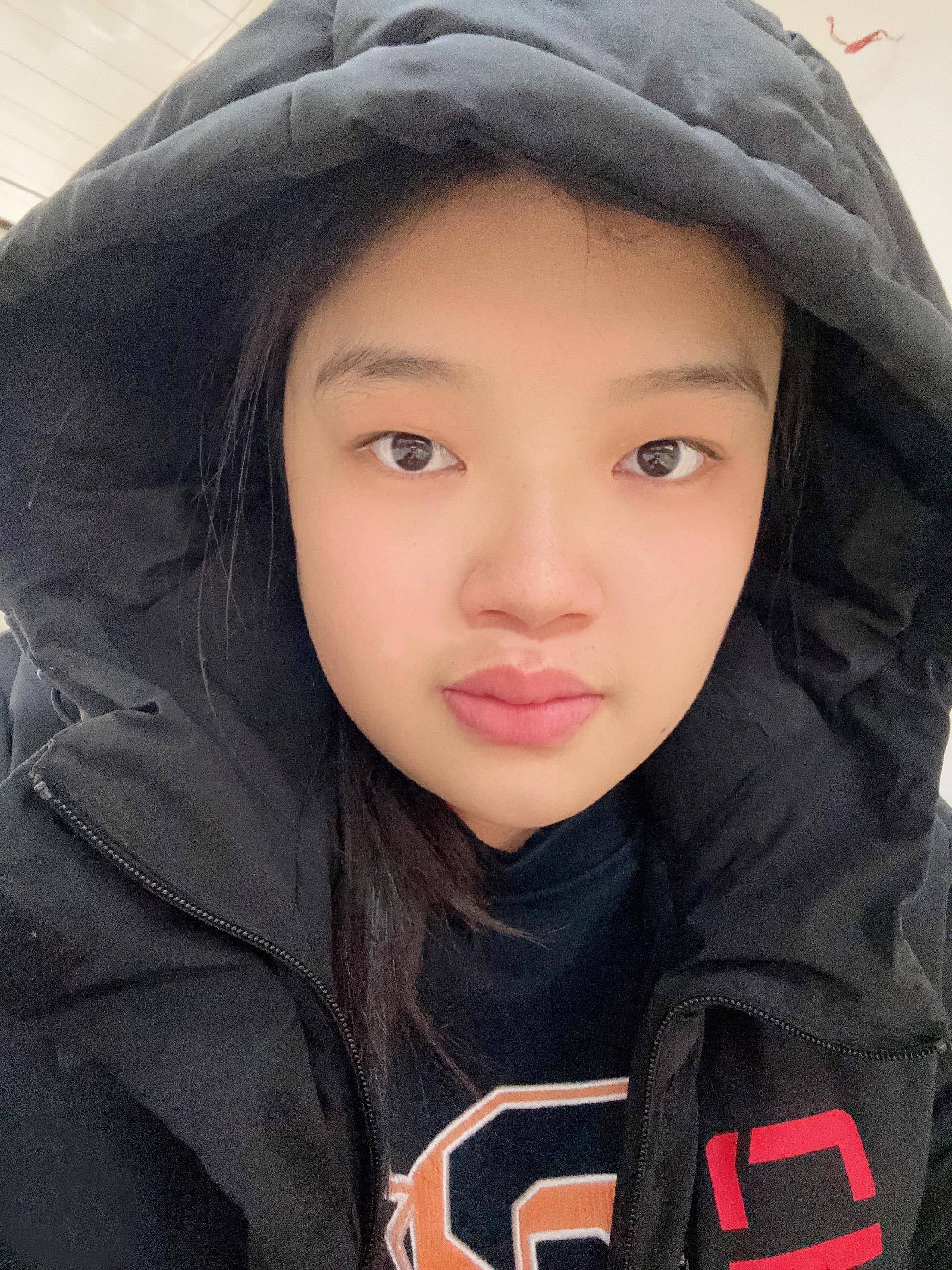 Wu Mengjie (Update on Wu Mengjie's injury)